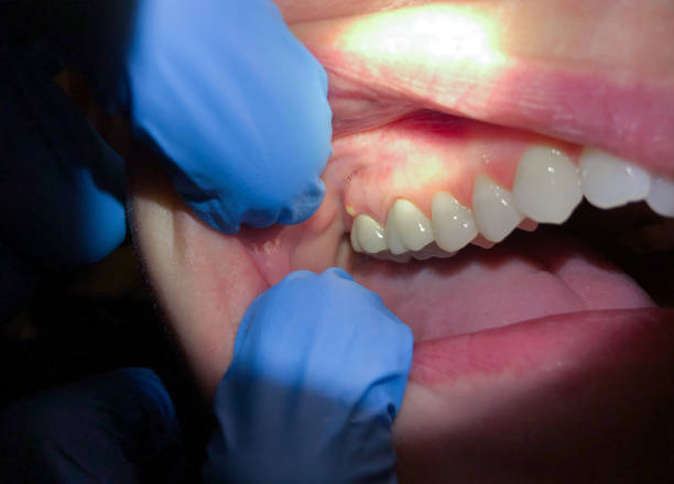 Best Emergency TMJ Treatment in Alice, TX
